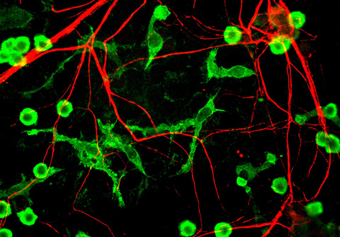 The neurons (green) and the microglia with their long branches (red) can be picked out in this microscopy image.