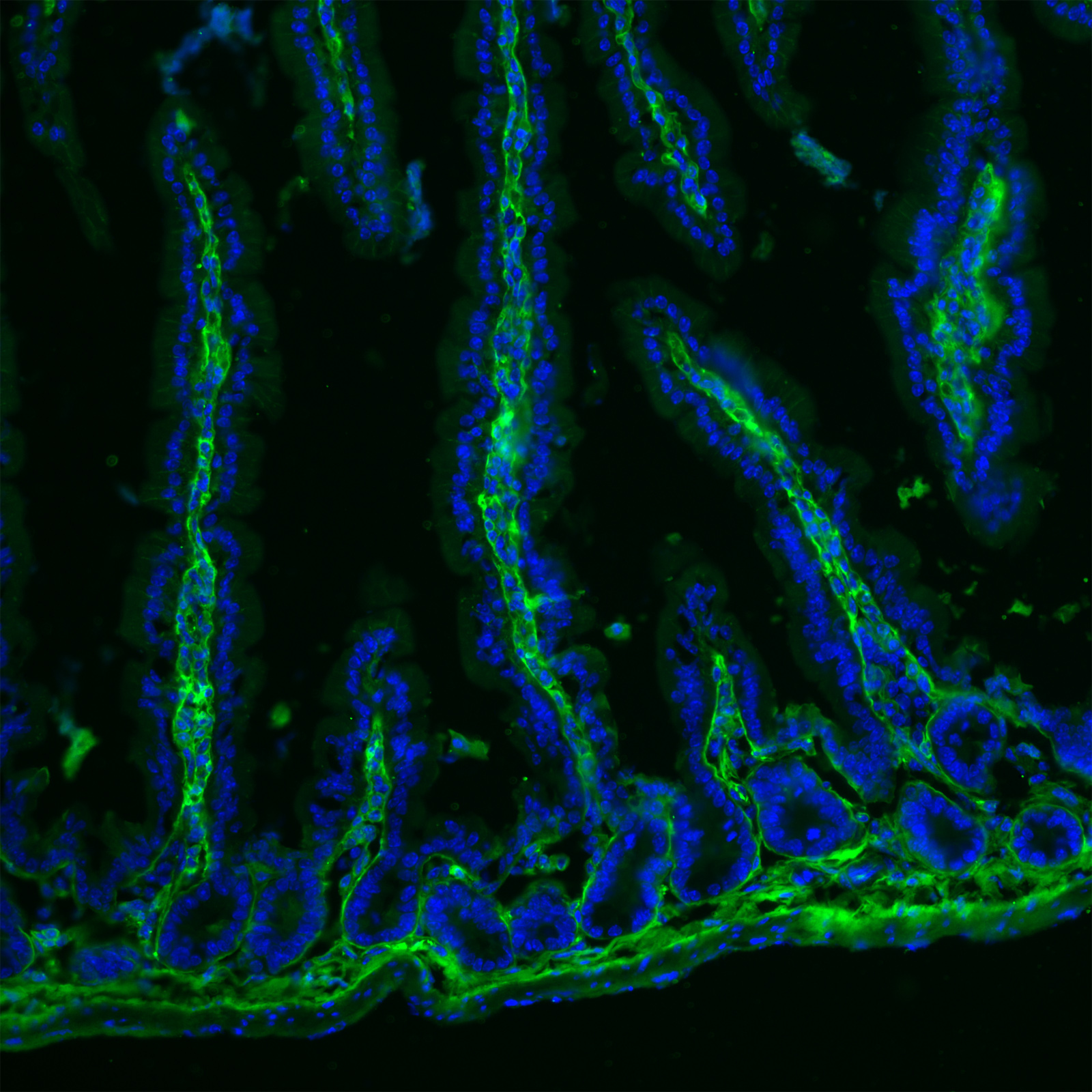 Imagen de fluorescencia de una muestra intestinal (Ainara Castellanos. UPV/EHU)