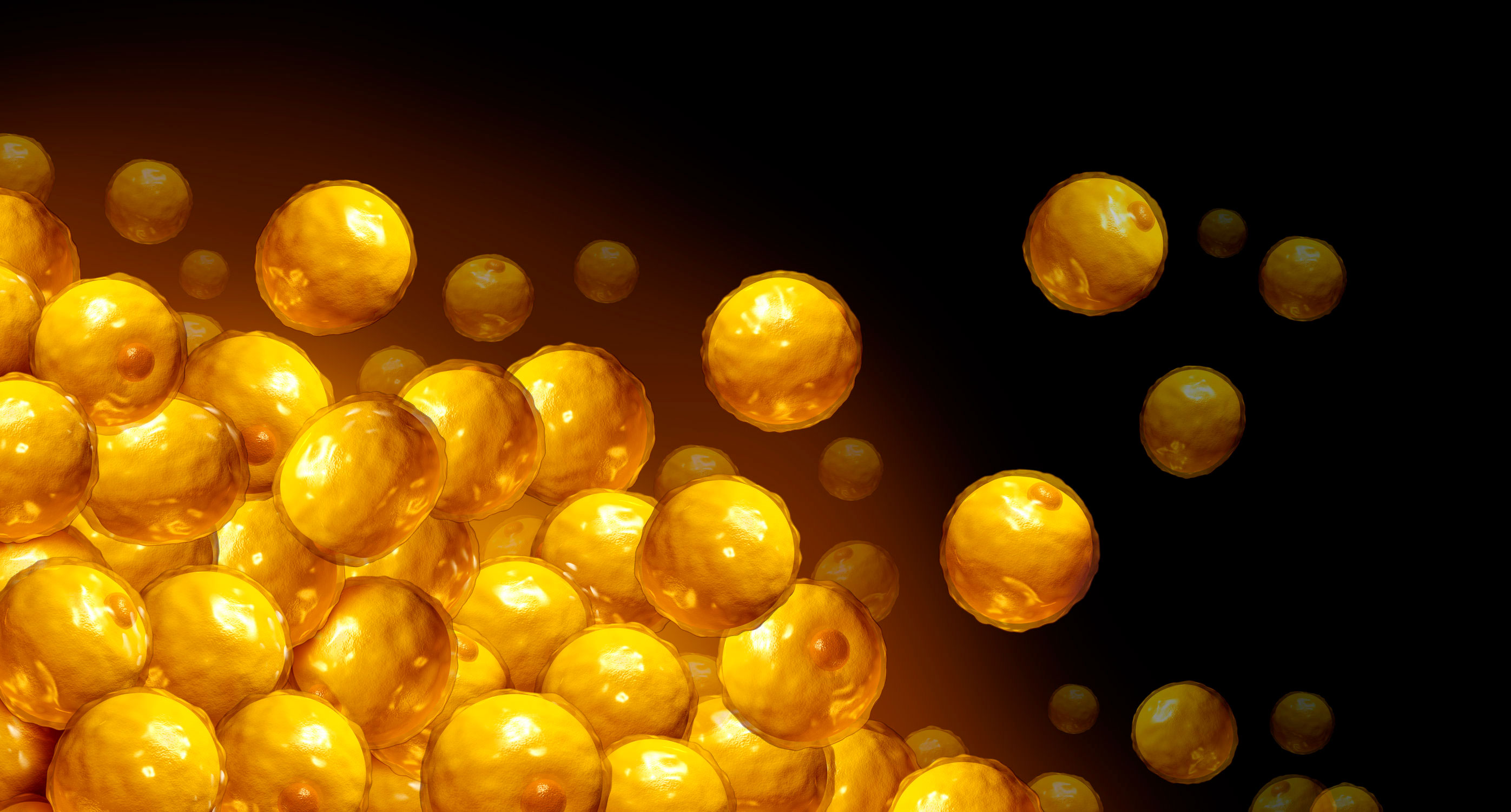 obesity adipose tissue