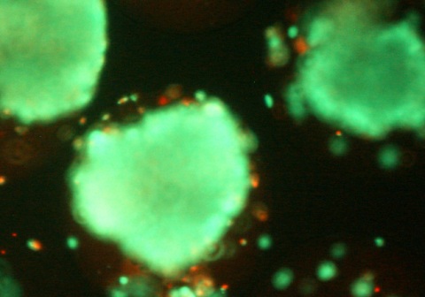 Células nanoencapsuladas