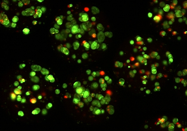 Proiektuan erabiliko diren alginato kapsulen formulazioak, ama zelula mesenkimalak dauzkatenak.