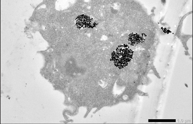 Makrofago baten irudia, hau da, sistema immuneko zelulena, magnetosomak bere barnean dituena. Argazkia: David Muñoz Rodríguez. Mitxi. UPV/EHU