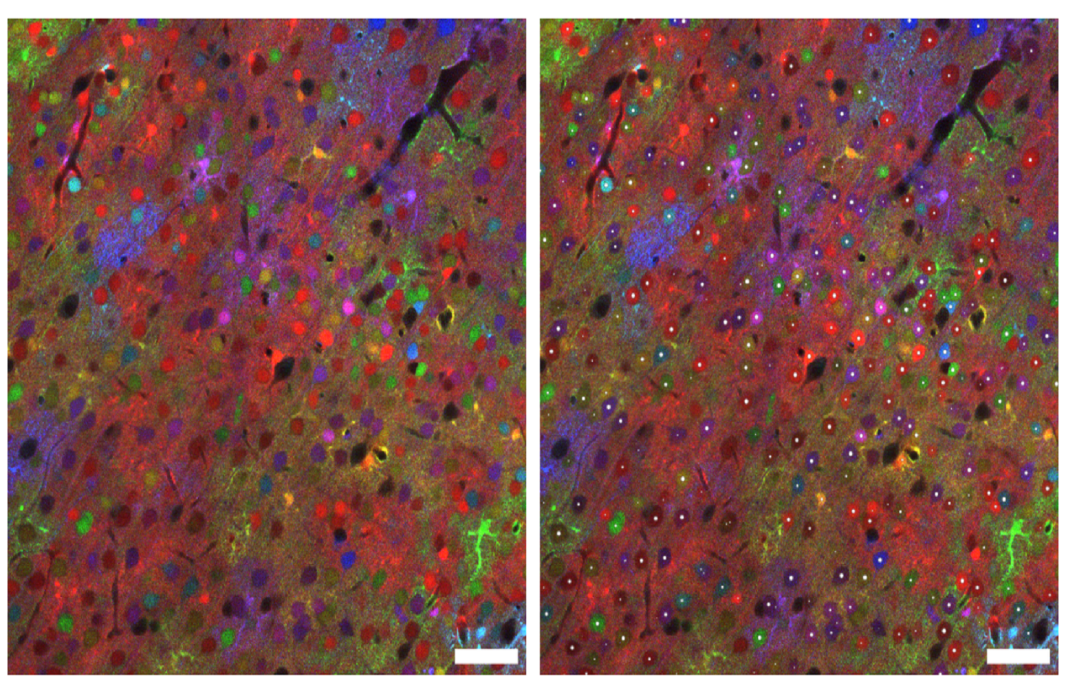Two-dimensional slice of a mouse brain region with fluorescent markers (image acquired with ChroMS). Each white dot represents an individual cell automatically detected by BiaPy, demonstrating its ability to analyse large images and detect cells in both densely populated and more sparse regions.
