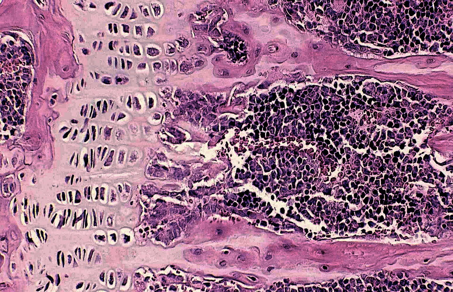 Erditze ondorengo hezur garapenean egindako behaketak