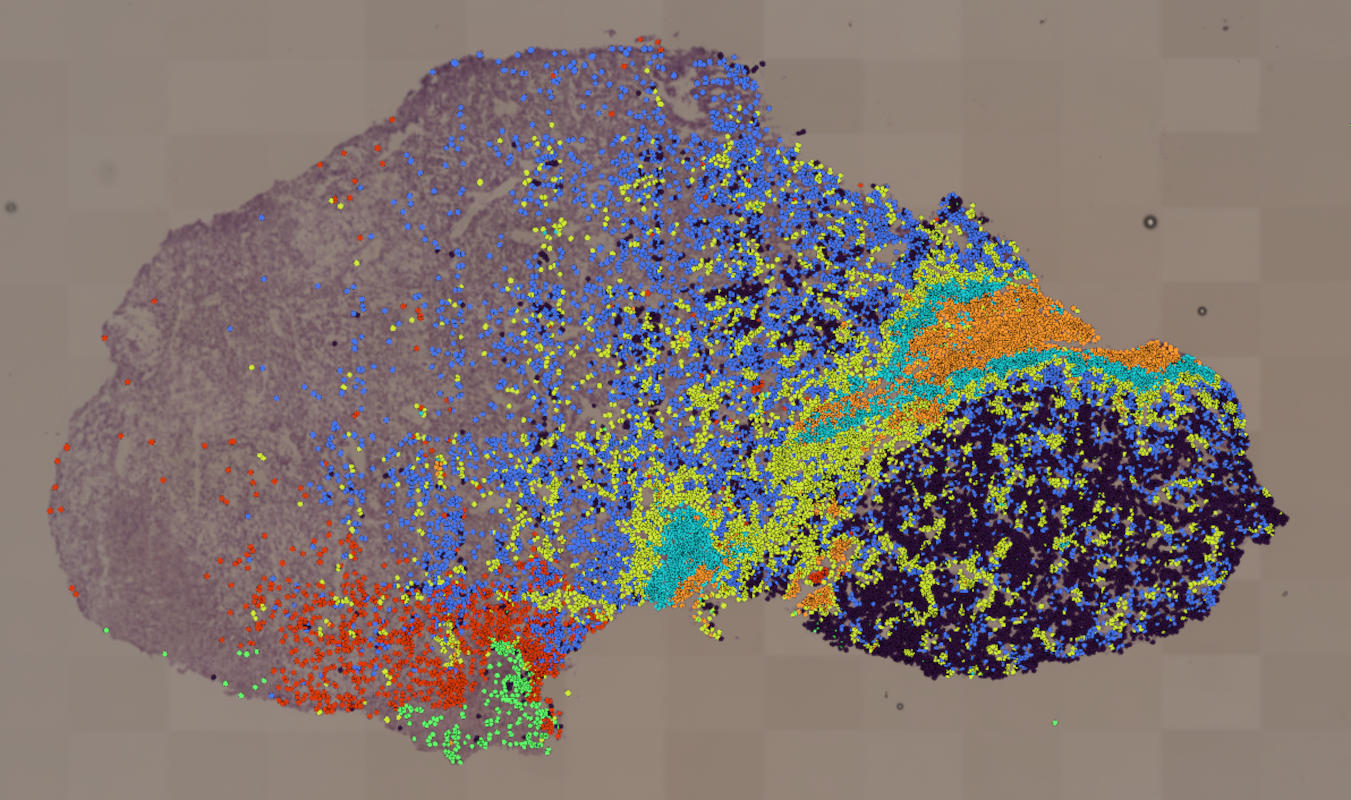 ccRCC clusters-277-002um