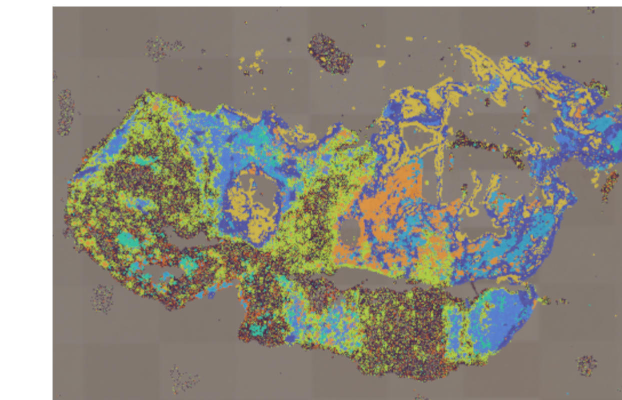 ccRCC ccRCC_1670-008um