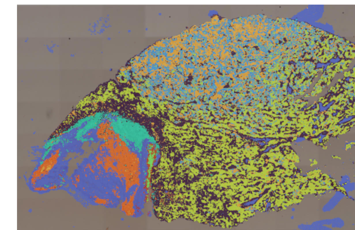 ccRCC ccRCC_m1680_008um