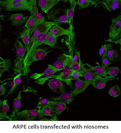 ARPE cells transfected with niosomes